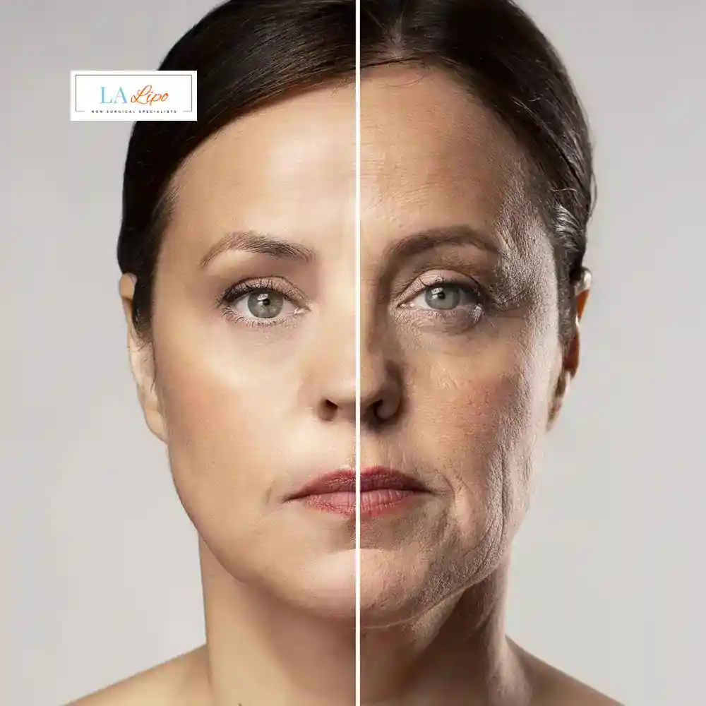 How Can You Tell If Non-Surgical Skin Tightening Is Right for You Sydenham?