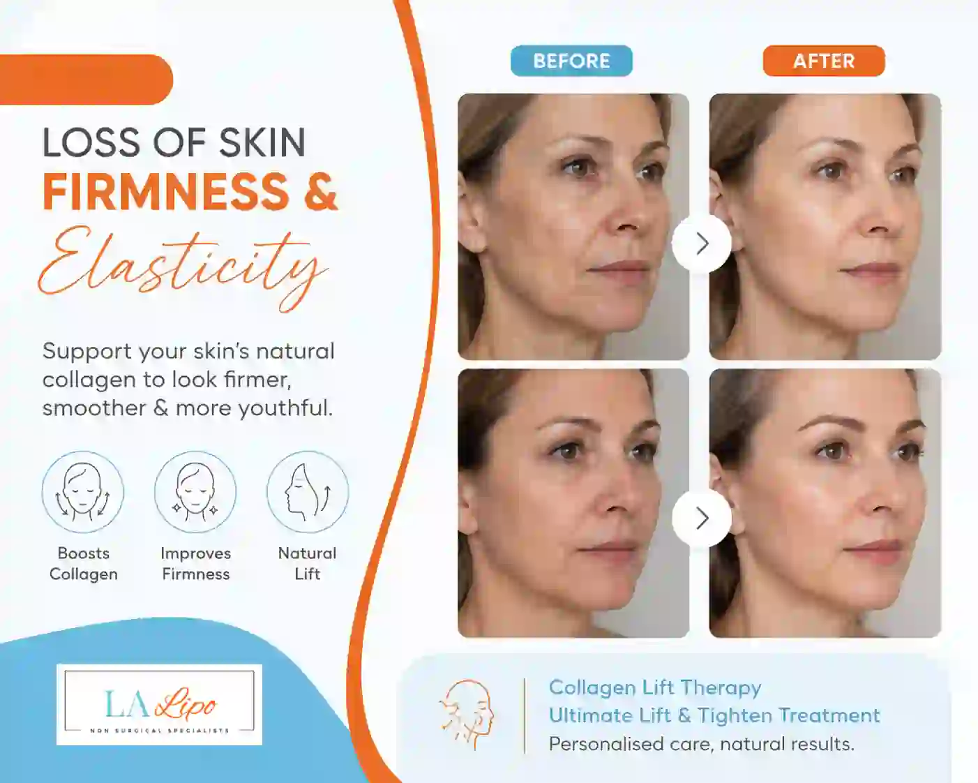 Sign #7: Loss of Skin Firmness and Elasticity Sydenham